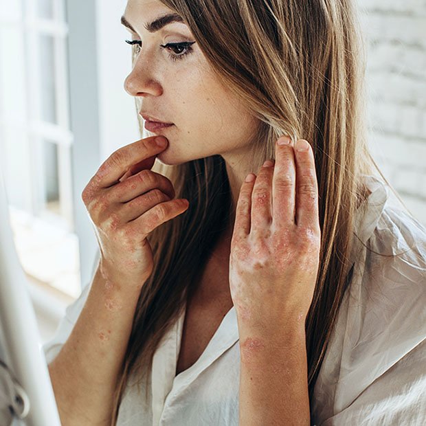 You are currently viewing Autoimmune Conditions and Eye Health