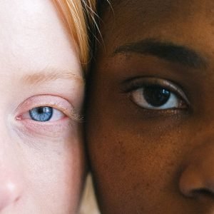 Read more about the article What Causes Different Eye Colors?