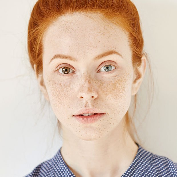 You are currently viewing What Do You Know About Heterochromia?